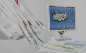 trattamenti-dentali